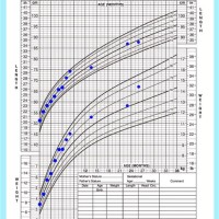 20 Month Old Weight Chart