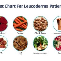 Aimil Healthcare T Chart For Leucoderma