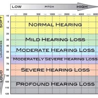 Audiology Hearing Test Chart