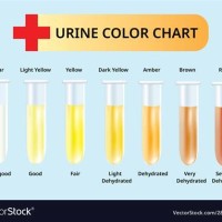 Baby Pregnancy Urine Color Chart