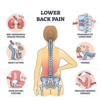 Back Pain Diagram Chart