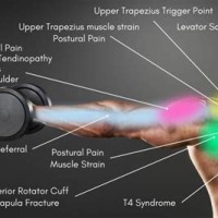 Back Shoulder Blade Pain Diagnosis Chart Reddit