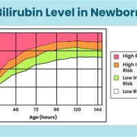 Bilirubin Levels In Newborns Chart