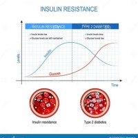 Blood Sugar Chart For Insulin Resistance