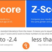 Bone Density Test Results Chart Z Score Interpretation