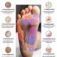 Bottom Of Foot Pain Chart