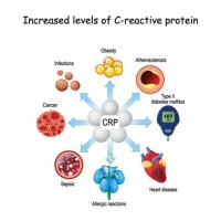 C Reactive Protein Level Chart Infection