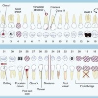 Charting Teeth Symbols