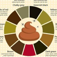 Child Stool Colour Chart