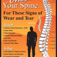 Chiropractic Posters And Charts