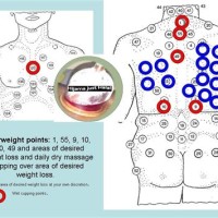 Cupping Points Chart For Weight Loss