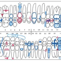 Definition Of Charting In Dentistry