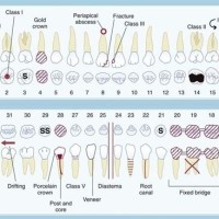 Dental Charting Colors And Symbols