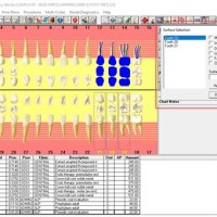 Dental Charting Symbols Dentrix