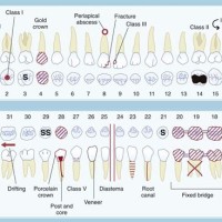 Dental Charting Symbols Quiz