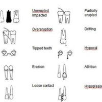 Dental Charting Symbols Uk