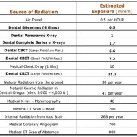 Dental Digital X Ray Exposure Chart