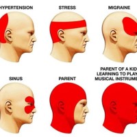 Diffe Types Of Headaches Chart