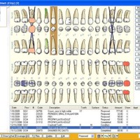 Eaglesoft Chart Setup