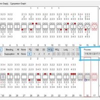 Eaglesoft Perio Charting Settings