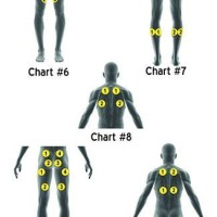 Electrical Stimulation Pad Placement Chart