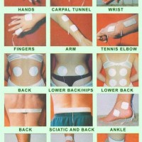 Empi Tens Unit Pad Placement Chart