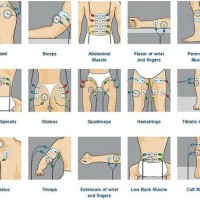 Ems Electrode Pad Placement Chart