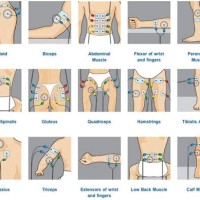 Estim Pad Placement Chart