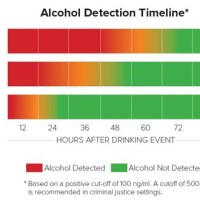 Etg Alcohol Test Detection Time Chart