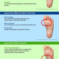 Foot Pain Diagnosis Chart Uk