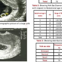 Gestational Sac And Yolk Size Chart