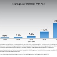 Hearing Loss By Age Chart