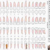How Do You Chart A Supernumerary Tooth In Eaglesoft