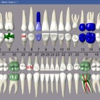 How To Change Tooth Chart In Open Dental