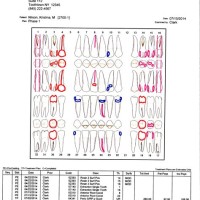 How To Chart In Dentistry