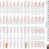 How To Chart Supernumerary Teeth In Eaglesoft 20