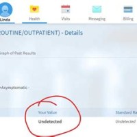 How To Find Covid Test Results On Mychart