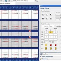 How To Find Perio Chart On Dentrix