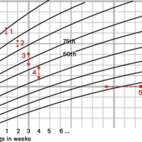 How To Interpret Centile Charts