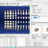 How To Merge Charts In Dentrix