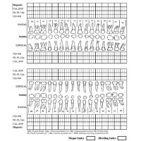 How To Perio Chart On Paper