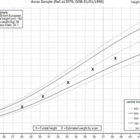 How To Plot Fetal Growth Chart