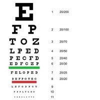 How To Read Snellen Eye Chart