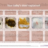 Infant Bowel Movement Color Chart