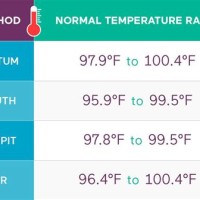 Infant Rectal Temperature Chart