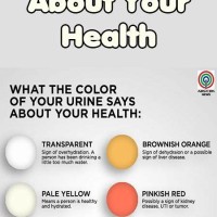 Infant Urine Color Chart