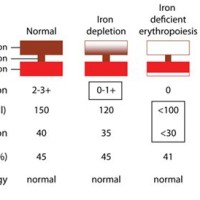 Iron Deficiency Anaemia Chart