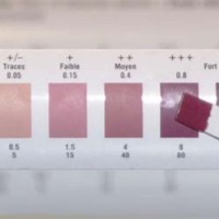 Ketone Strips Color Chart