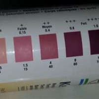 Ketone Urine Test Strips Color Chart