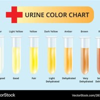 Newborn Baby Urine Color Chart